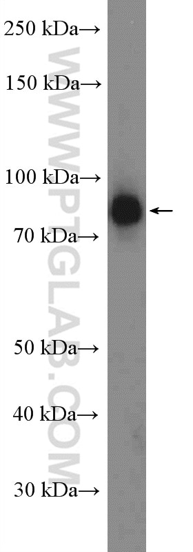 Western Blot (WB) analysis of HeLa cells using P3H1 Polyclonal antibody (26691-1-AP)