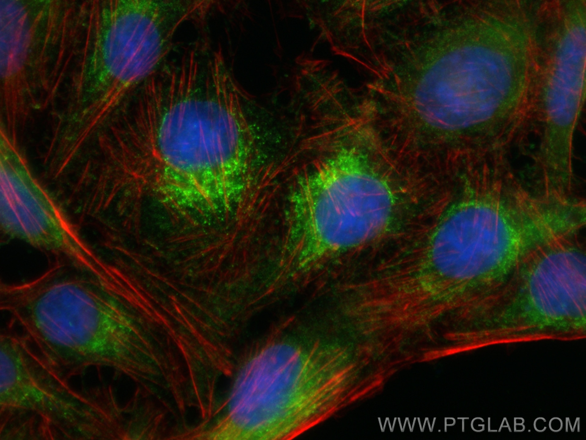 Immunofluorescence (IF) / fluorescent staining of U2OS cells using P4HA1 Polyclonal antibody (12658-1-AP)