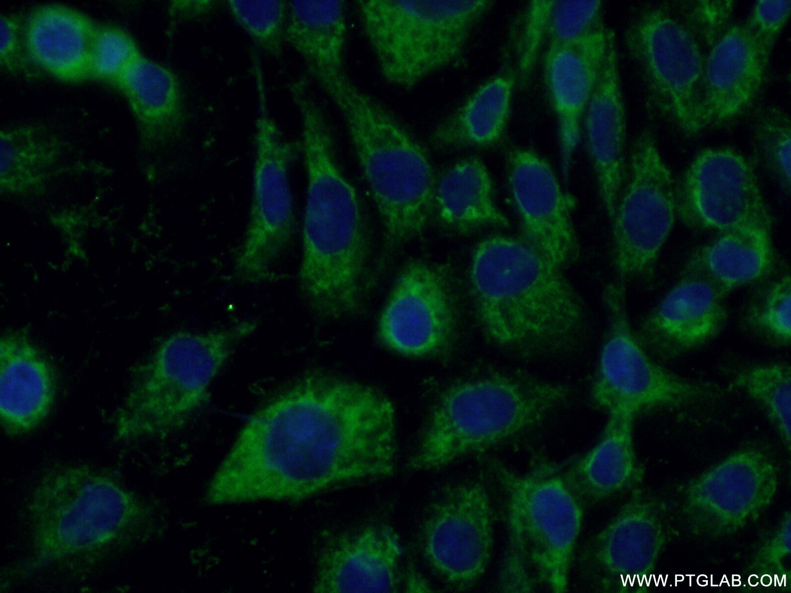 Immunofluorescence (IF) / fluorescent staining of A431 cells using P4HA1 Polyclonal antibody (12658-1-AP)