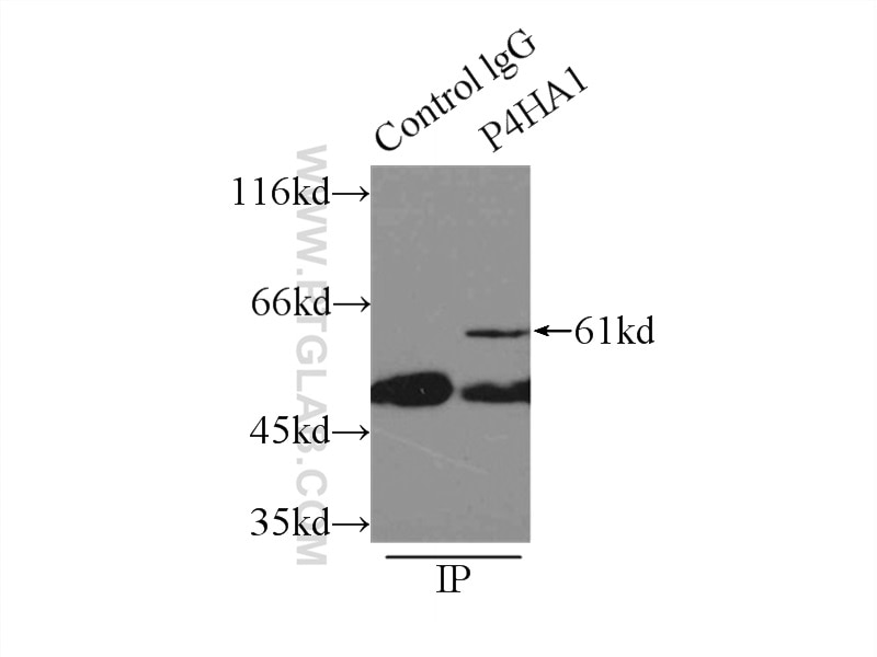 Immunoprecipitation (IP) experiment of A431 cells using P4HA1 Polyclonal antibody (12658-1-AP)