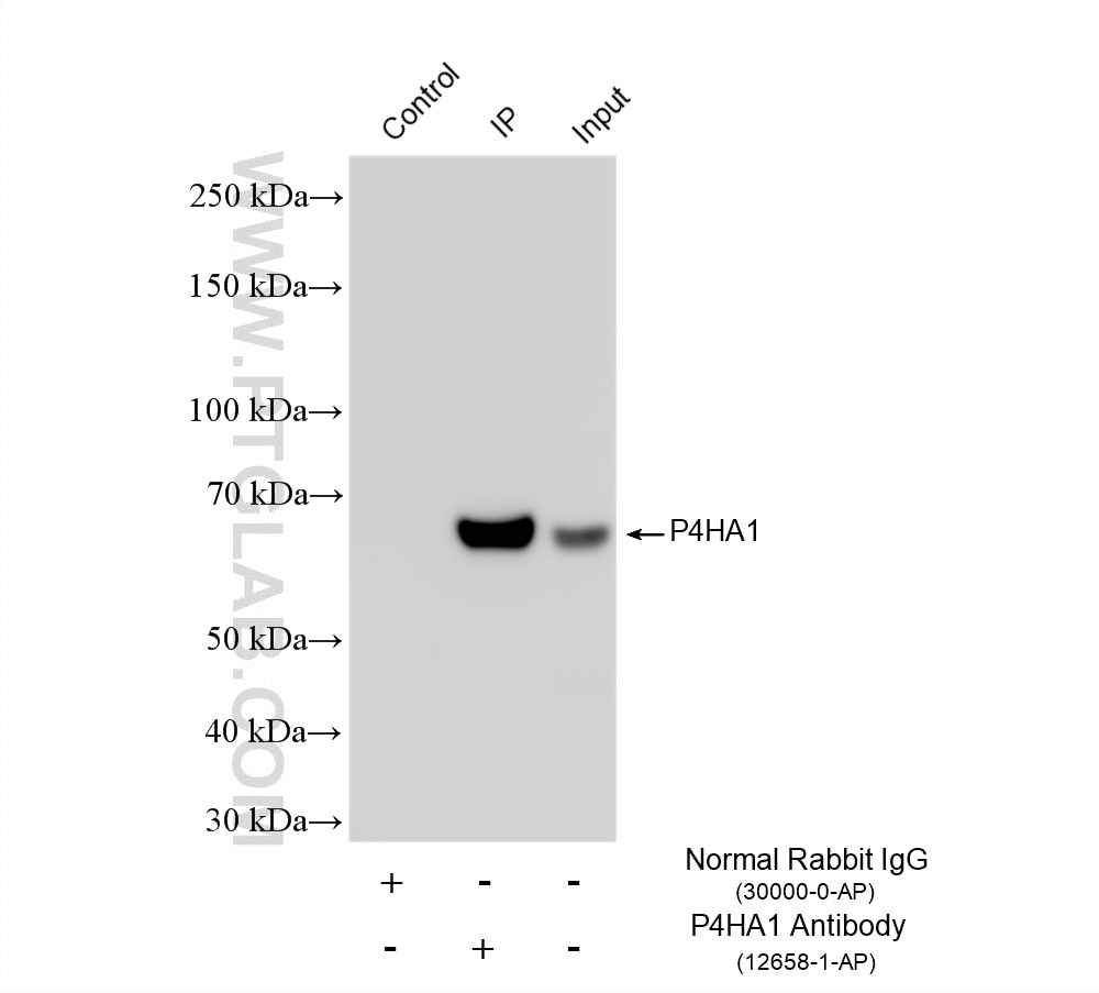 Immunoprecipitation (IP) experiment of LNCaP cells using P4HA1 Polyclonal antibody (12658-1-AP)