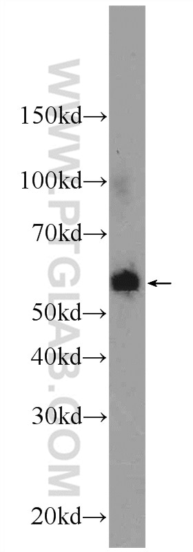 Western Blot (WB) analysis of rat skin tissue using P4HA1 Polyclonal antibody (12658-1-AP)