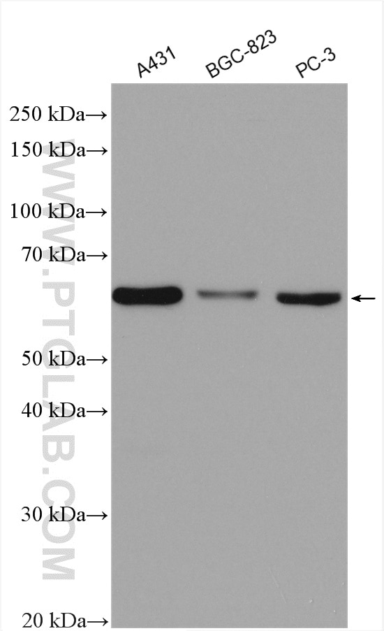Western Blot (WB) analysis of various lysates using P4HA1 Polyclonal antibody (12658-1-AP)