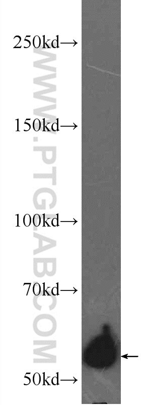 Western Blot (WB) analysis of NIH/3T3 cells using P4HA1 Polyclonal antibody (12658-1-AP)