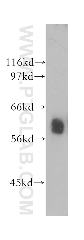 Western Blot (WB) analysis of human heart tissue using P4HA1 Polyclonal antibody (12658-1-AP)