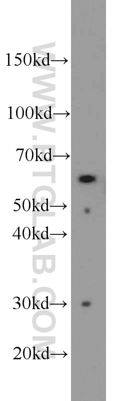 Western Blot (WB) analysis of HT-1080 cells using P4HA1 Polyclonal antibody (12658-1-AP)