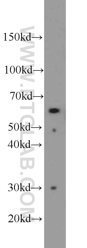 WB analysis of HT-1080 using 12658-1-AP