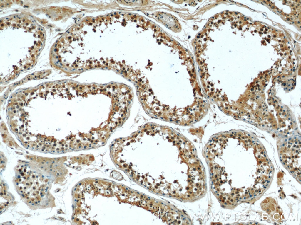 Immunohistochemistry (IHC) staining of human testis tissue using P4HA1 Monoclonal antibody (66101-1-Ig)