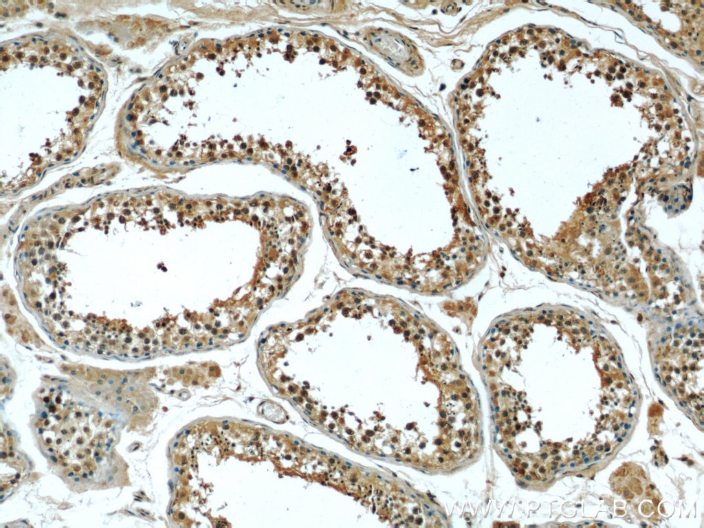 IHC staining of human testis using 66101-1-Ig