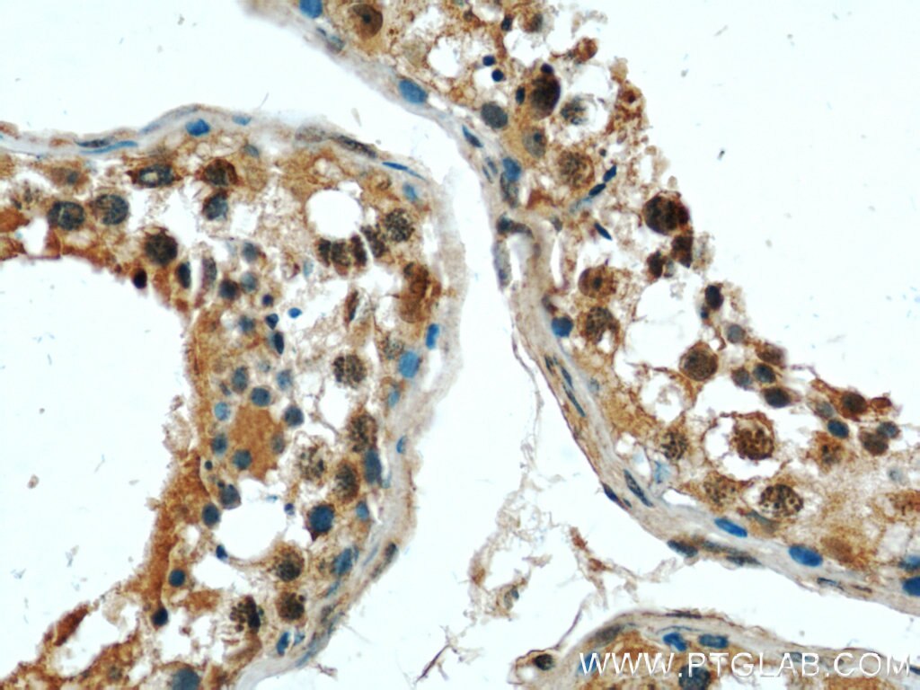 Immunohistochemistry (IHC) staining of human testis tissue using P4HA1 Monoclonal antibody (66101-1-Ig)