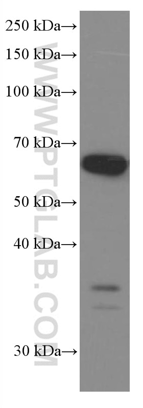 Western Blot (WB) analysis of HSC-T6 cells using P4HA1 Monoclonal antibody (66101-1-Ig)