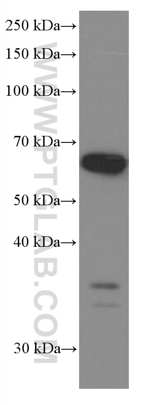 WB analysis of HSC-T6 using 66101-1-Ig