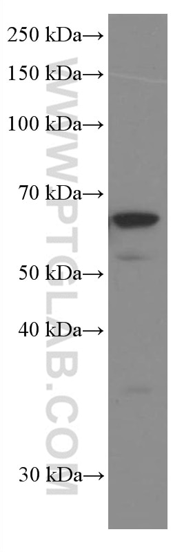 Western Blot (WB) analysis of ROS1728 cells using P4HA1 Monoclonal antibody (66101-1-Ig)