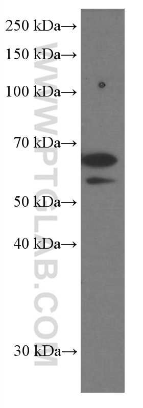 Western Blot (WB) analysis of Neuro-2a cells using P4HA1 Monoclonal antibody (66101-1-Ig)