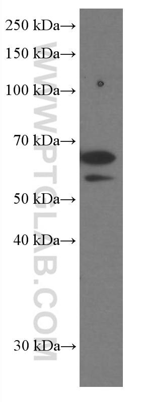 WB analysis of Neuro-2a using 66101-1-Ig