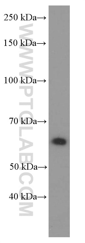 Western Blot (WB) analysis of 4T1 cells using P4HA1 Monoclonal antibody (66101-1-Ig)