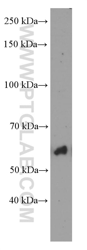 Western Blot (WB) analysis of rat liver tissue using P4HA1 Monoclonal antibody (66101-1-Ig)