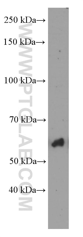 Western Blot (WB) analysis of rat liver tissue using P4HA1 Monoclonal antibody (66101-1-Ig)