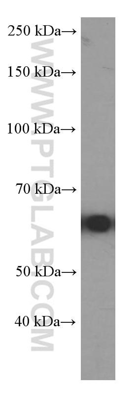 Western Blot (WB) analysis of NIH/3T3 cells using P4HA1 Monoclonal antibody (66101-1-Ig)
