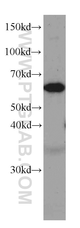 Western Blot (WB) analysis of HEK-293 cells using P4HA1 Monoclonal antibody (66101-1-Ig)