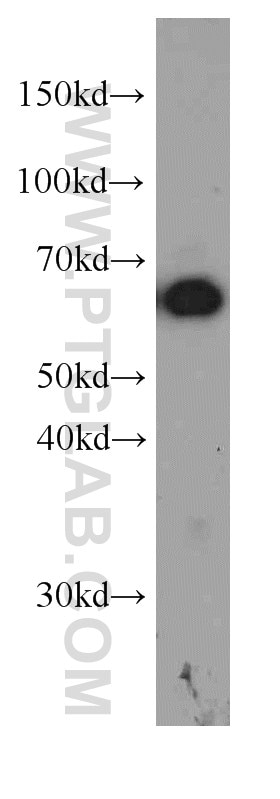 Western Blot (WB) analysis of PC-3 cells using P4HA1 Monoclonal antibody (66101-1-Ig)