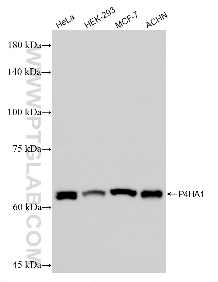 Western Blot (WB) analysis of various lysates using P4HA1 Recombinant monoclonal antibody (86825-1-RR)
