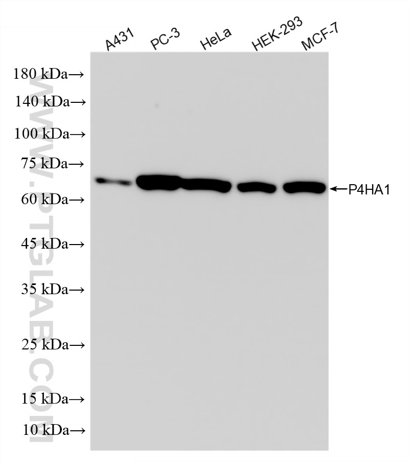 Western Blot (WB) analysis of various lysates using P4HA1 Recombinant monoclonal antibody (86825-1-RR)
