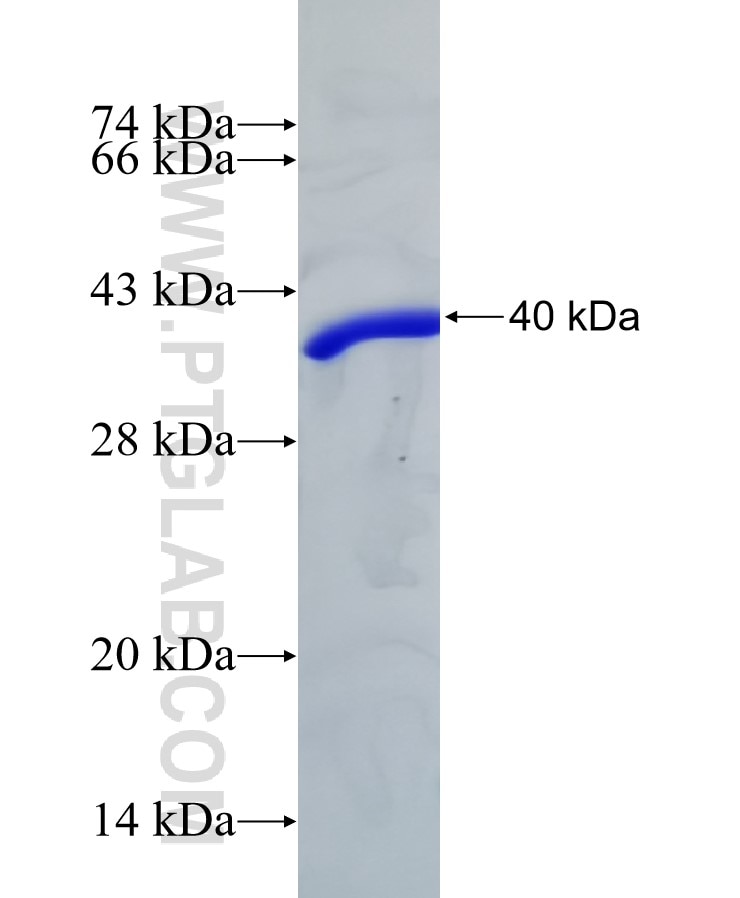P4HA1 fusion protein Ag17867 SDS-PAGE