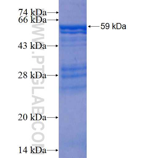 P4HA1 fusion protein Ag3292 SDS-PAGE