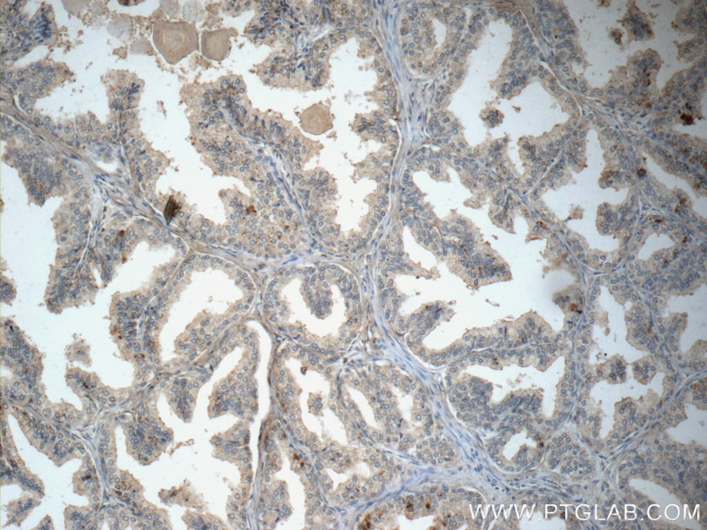 P4HA2 Antibody IHC mouse ovary tissue 13759-1-AP