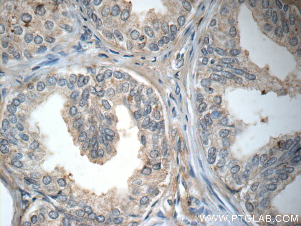 P4HA2 Antibody IHC mouse ovary tissue 13759-1-AP