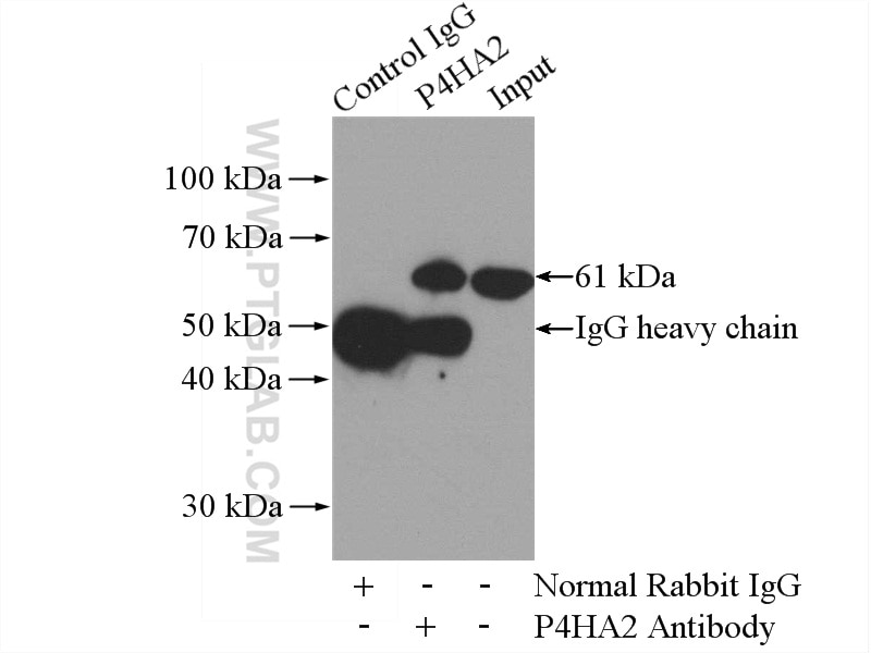 Immunoprecipitation (IP) experiment of HeLa cells using P4HA2 Polyclonal antibody (13759-1-AP)