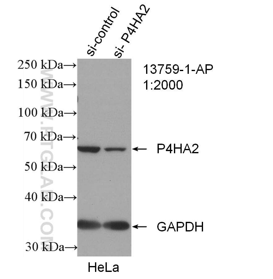 Western Blot (WB) analysis of HeLa cells using P4HA2 Polyclonal antibody (13759-1-AP)