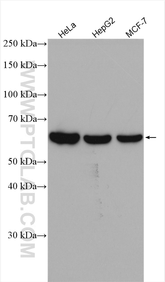 Western Blot (WB) analysis of various lysates using P4HA2 Polyclonal antibody (13759-1-AP)