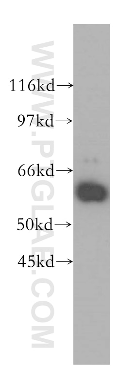 Western Blot (WB) analysis of HeLa cells using P4HA2 Polyclonal antibody (13759-1-AP)