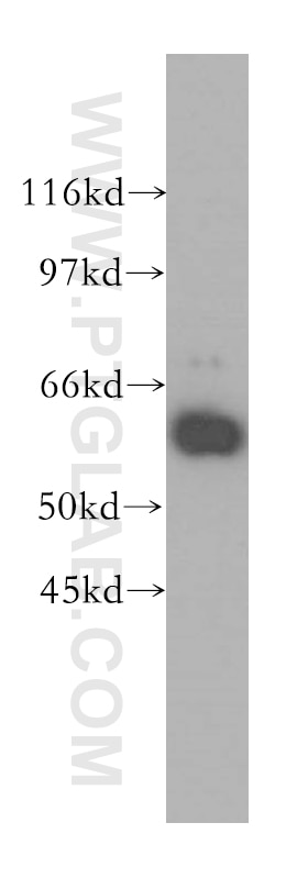 WB analysis of HeLa using 13759-1-AP