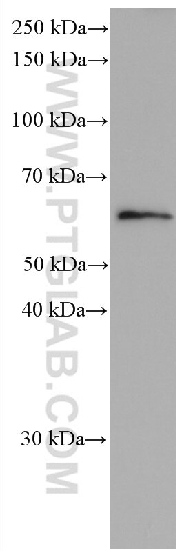 Western Blot (WB) analysis of HeLa cells using P4HA2 Monoclonal antibody (66604-1-Ig)