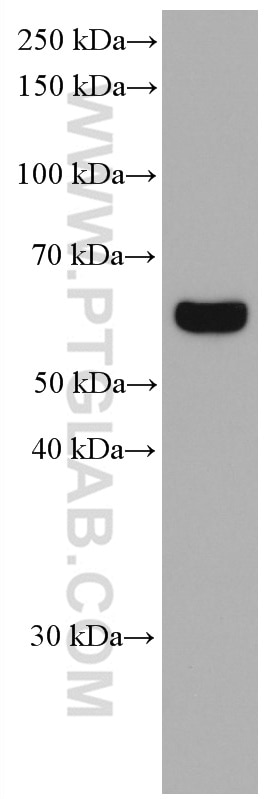 Western Blot (WB) analysis of HSC-T6 cells using P4HA2 Monoclonal antibody (66604-1-Ig)