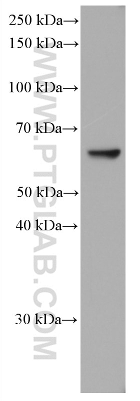 Western Blot (WB) analysis of NIH/3T3 cells using P4HA2 Monoclonal antibody (66604-1-Ig)