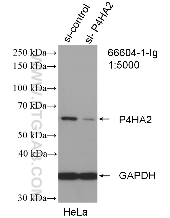 Western Blot (WB) analysis of HeLa cells using P4HA2 Monoclonal antibody (66604-1-Ig)