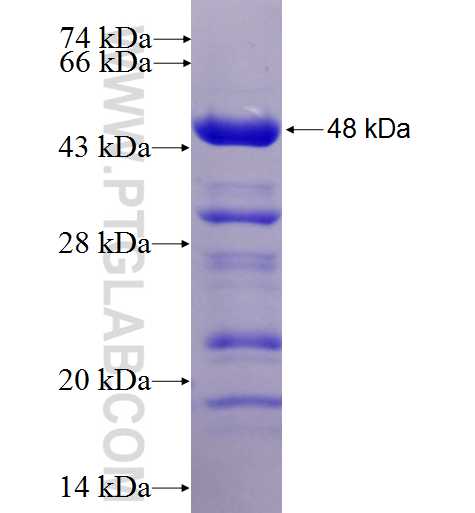 P4HA2 fusion protein Ag4714 SDS-PAGE