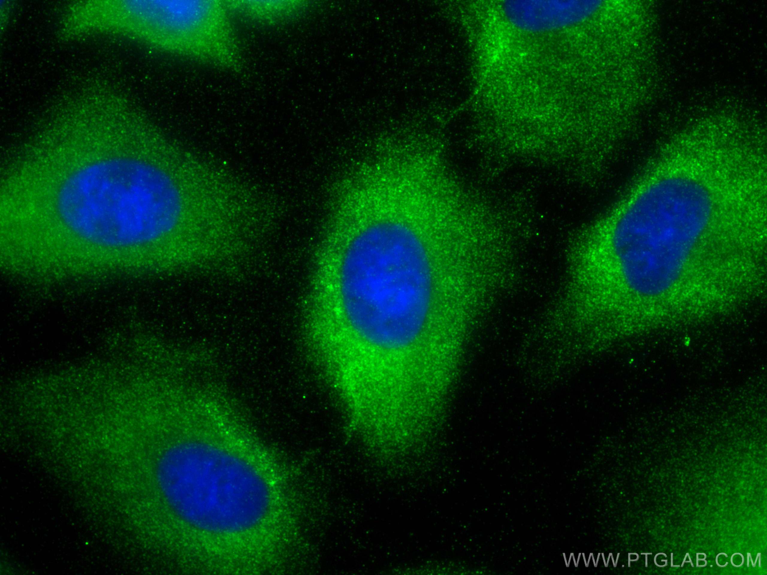 Immunofluorescence (IF) / fluorescent staining of A549 cells using P4HA3 Polyclonal antibody (23185-1-AP)