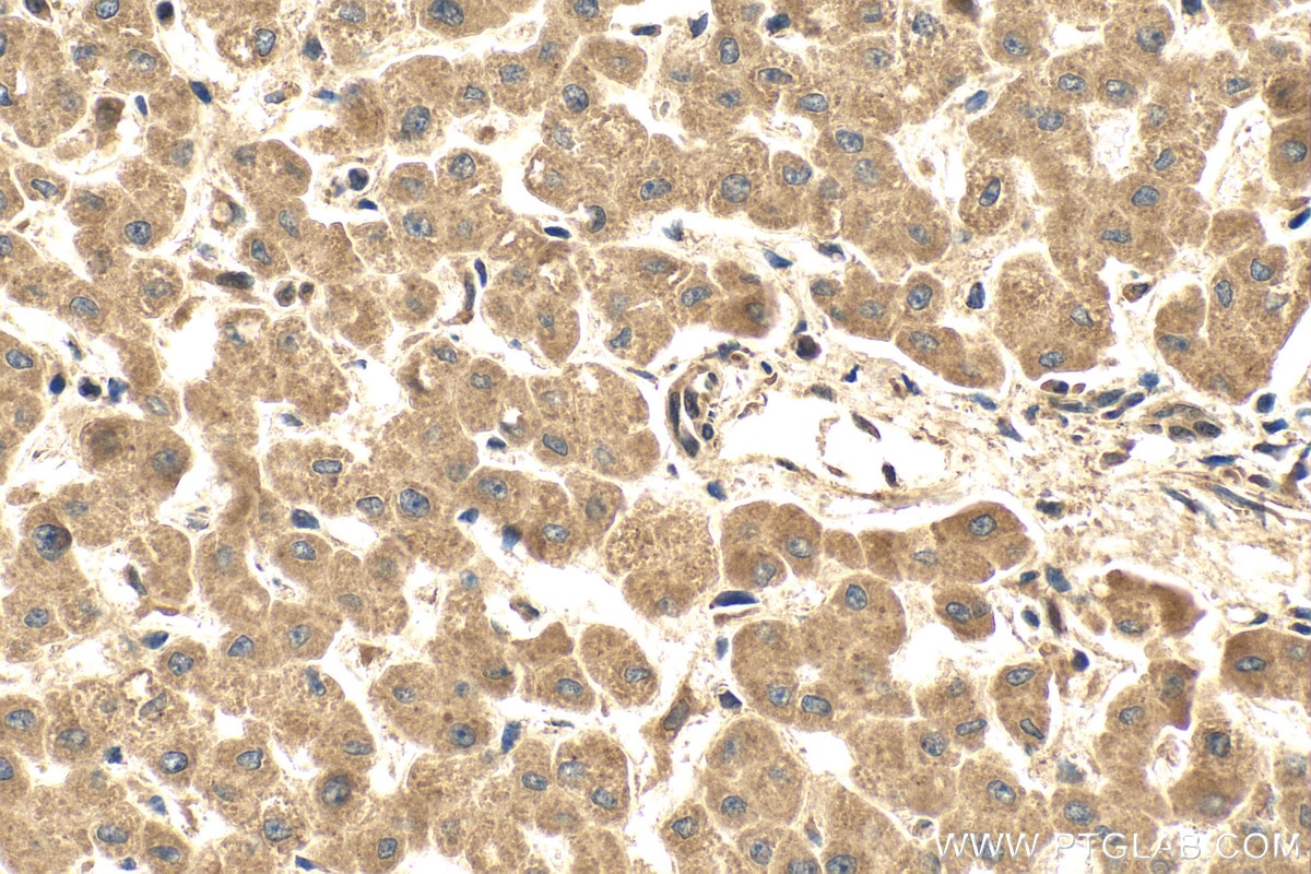 Immunohistochemical analysis of paraffin-embedded human liver tissue slide using 23185-1-AP (P4HA3 antibody) at dilution of 1:100 (under 40x lens). Heat mediated antigen retrieval with Tris-EDTA buffer (pH 9.0). Immunohistochemistry (IHC) staining of human liver tissue using P4HA3 Polyclonal antibody (23185-1-AP)