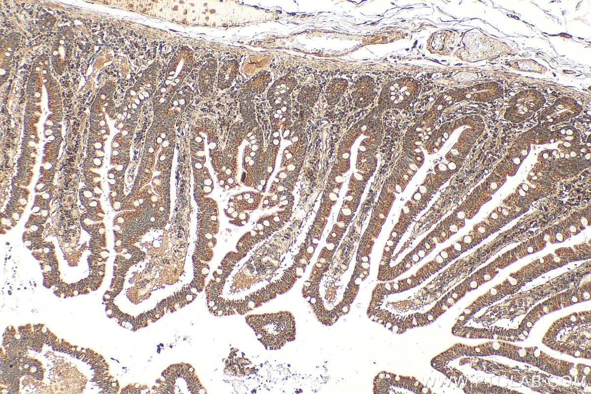 Immunohistochemical analysis of paraffin-embedded human small intestine tissue slide using 23185-1-AP (P4HA3 antibody) at dilution of 1:100 (under 10x lens). Heat mediated antigen retrieval with Tris-EDTA buffer (pH 9.0). Immunohistochemistry (IHC) staining of human small intestine tissue using P4HA3 Polyclonal antibody (23185-1-AP)