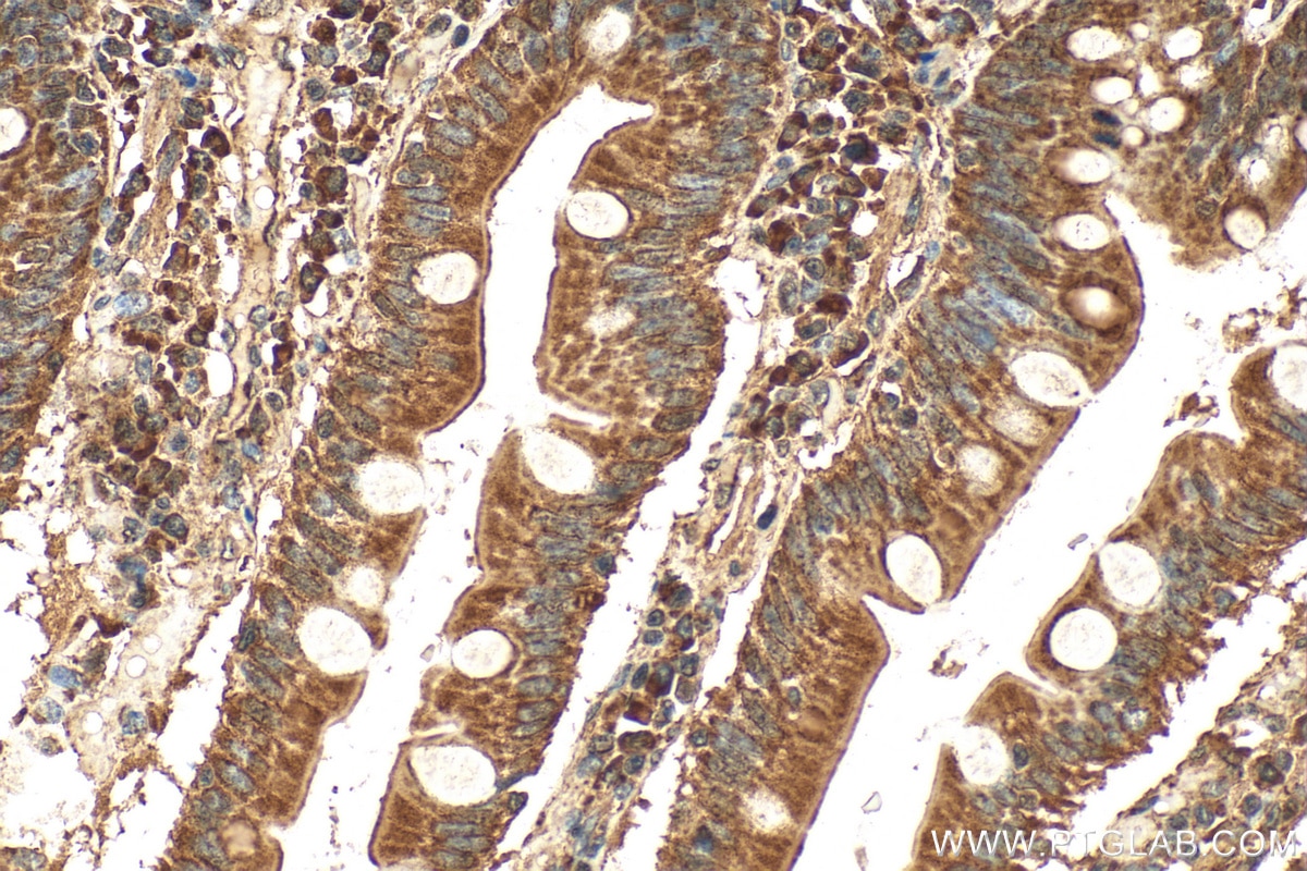 Immunohistochemical analysis of paraffin-embedded human small intestine tissue slide using 23185-1-AP (P4HA3 antibody) at dilution of 1:100 (under 40x lens). Heat mediated antigen retrieval with Tris-EDTA buffer (pH 9.0). Immunohistochemistry (IHC) staining of human small intestine tissue using P4HA3 Polyclonal antibody (23185-1-AP)