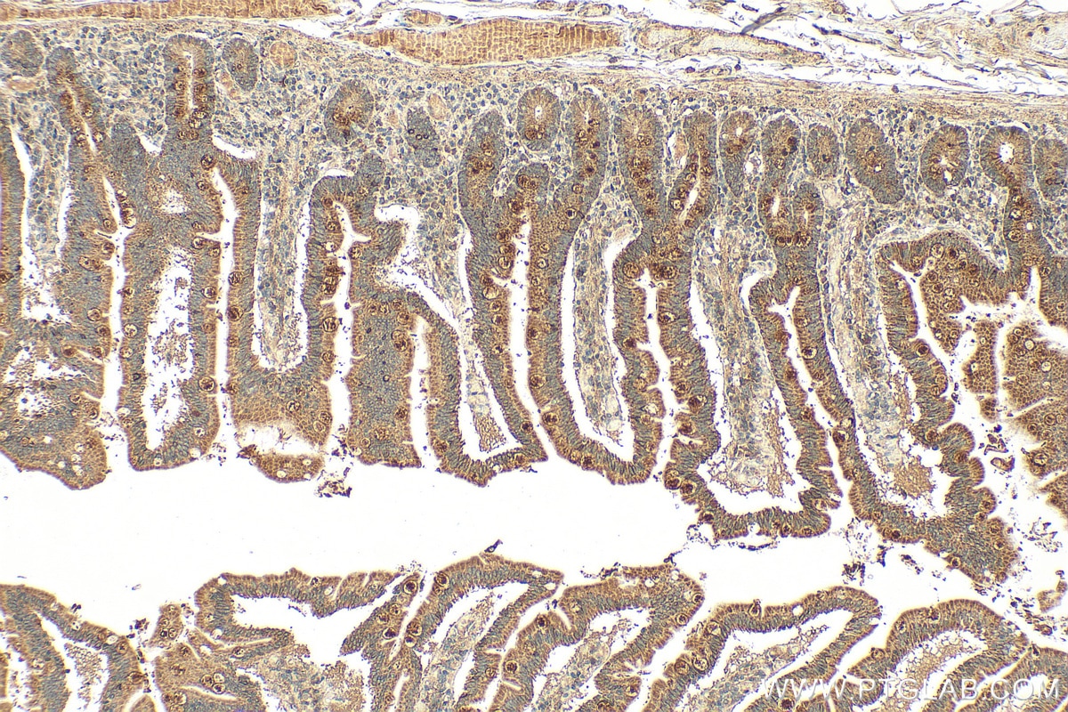 Immunohistochemistry (IHC) staining of human small intestine tissue using P4HA3 Polyclonal antibody (23185-1-AP)