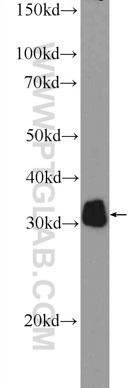 Western Blot (WB) analysis of mouse kidney tissue using P4HA3 Polyclonal antibody (23185-1-AP)