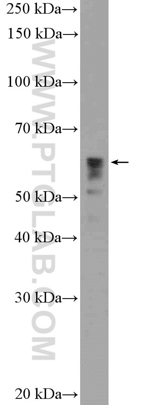 Western Blot (WB) analysis of A549 cells using P4HA3 Polyclonal antibody (23185-1-AP)