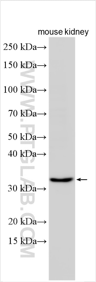 WB analysis using 23185-1-AP