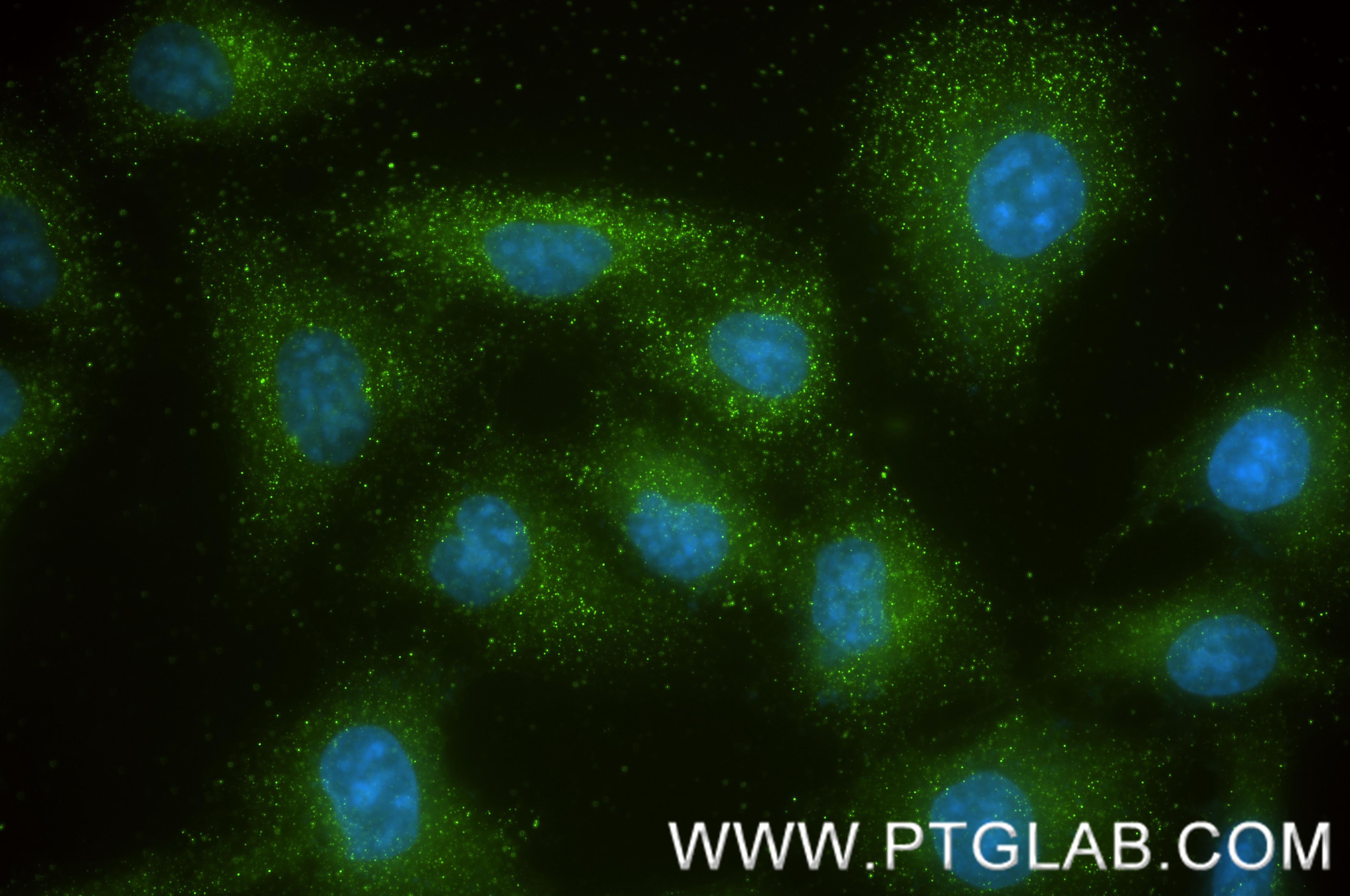 Immunofluorescent analysis of (-20°C Ethanol) fixed A549 cells using P4HA3 antibody (85374-1-RR, Clone: 242750C3 ) at dilution of 1:200 and CoraLite®488-Conjugated Goat Anti-Rabbit IgG(H+L) (SA00013-2). This data was developed using the same antibody clone with 85374-1-PBS in a different storage buffer formulation. Immunofluorescence (IF) / fluorescent staining of A549 cells using P4HA3 Recombinant monoclonal antibody (85374-1-RR)